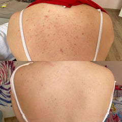 Gluta & Rice Body Lotion