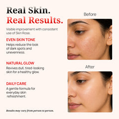 Rose Water Glow 30ml